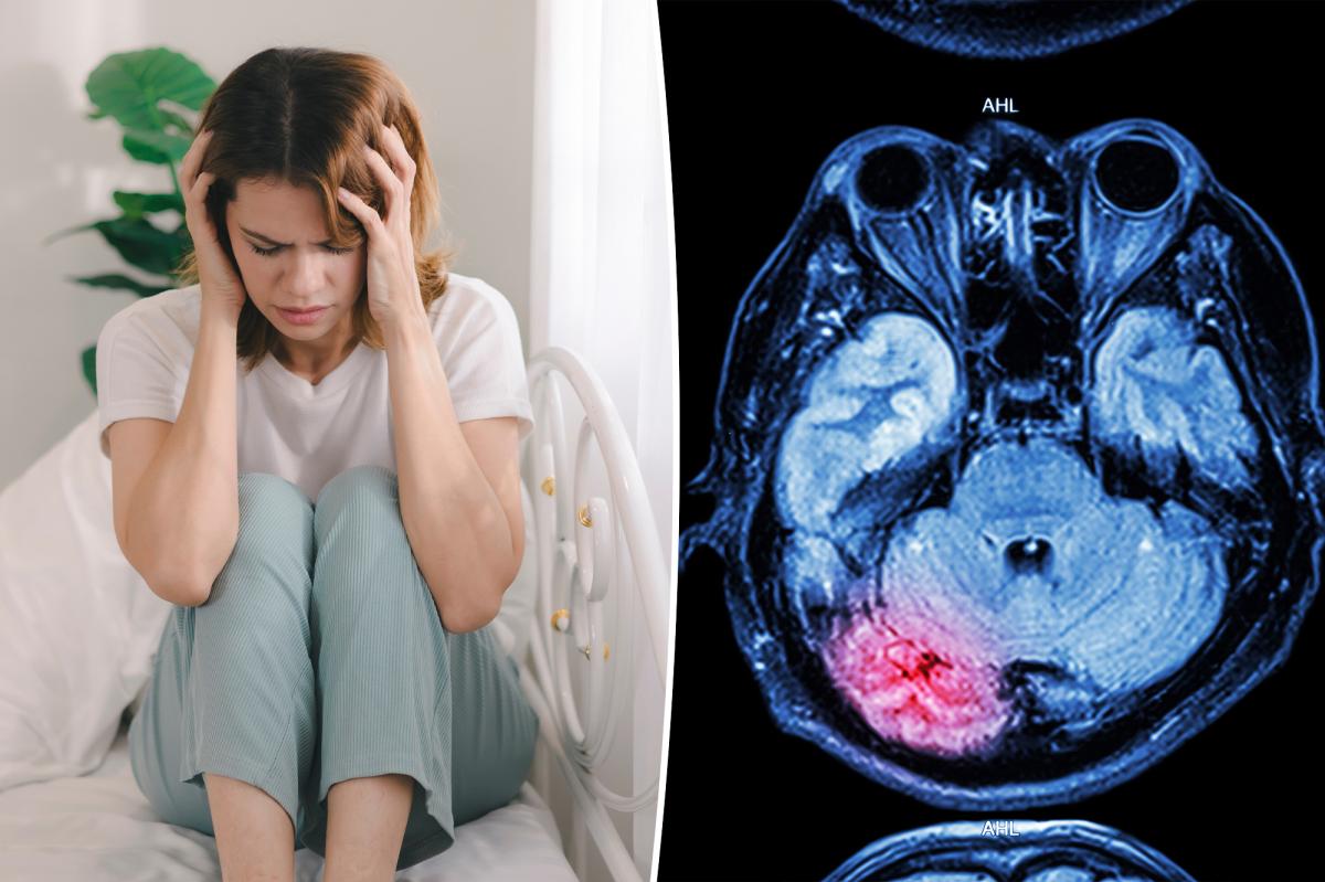 Why Stroke Rates Are Surging Among Young Adults