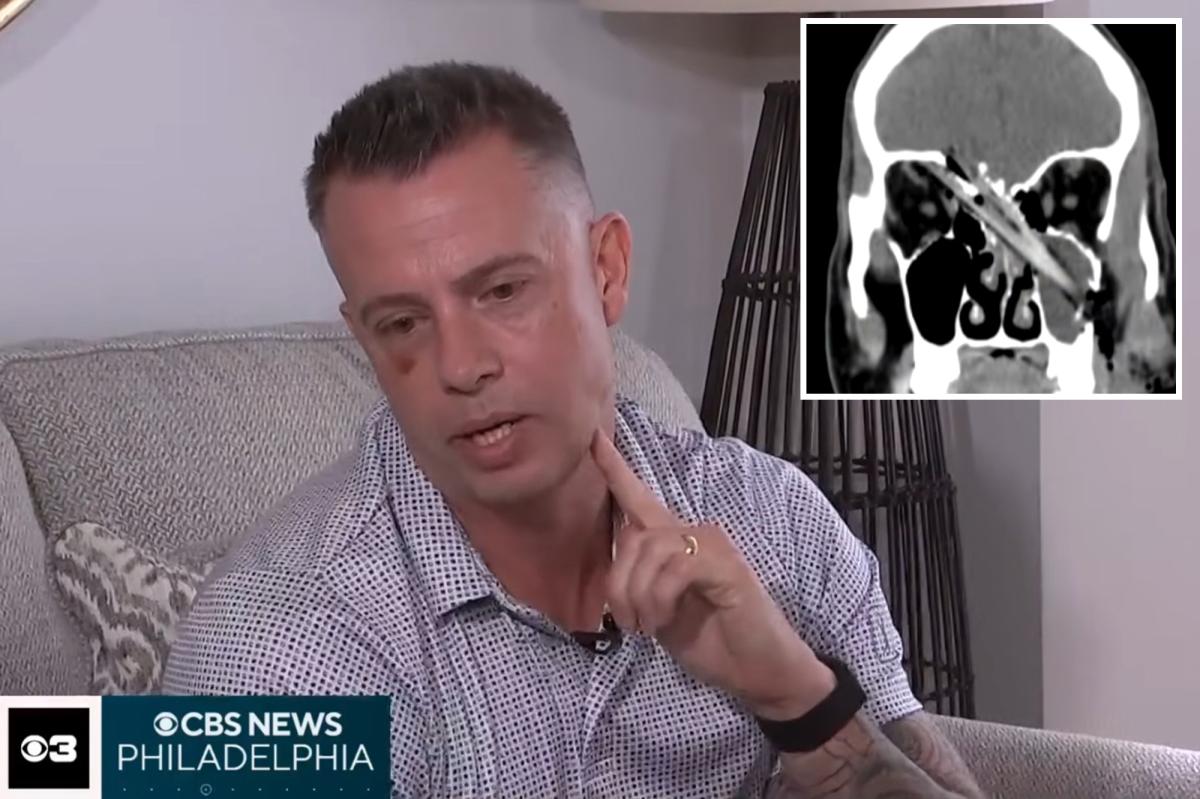 The Mind-Boggling Survival of NJ Dad After Tree Branch Impalement